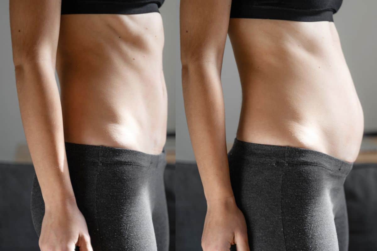 How long does diastasis recti take to improve Northwood Hills?