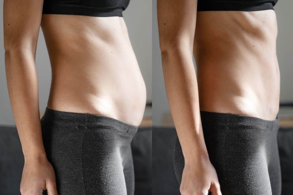 Post-Pregnancy: What Happens to Your Abdominal Muscles After Birth Northwood Hills