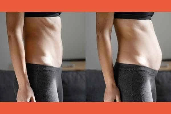 LA-EMS Body Sculpting results Northwood Hills