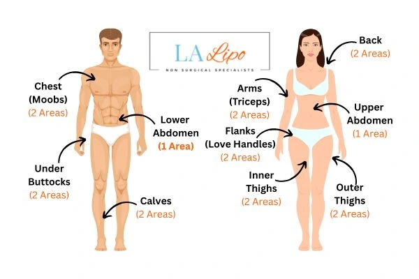 LA LIPO Cryolipolysis Areas Northwood Hills