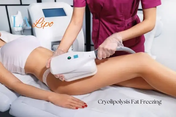 Woman receiving coolsculpting Northwood Hills treatment on her thighs