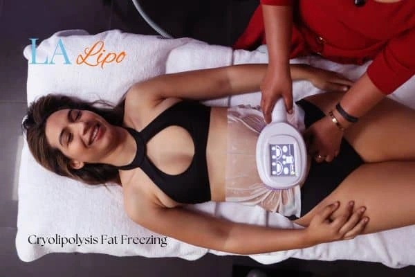 woman getting cryolipolysis Northwood Hills