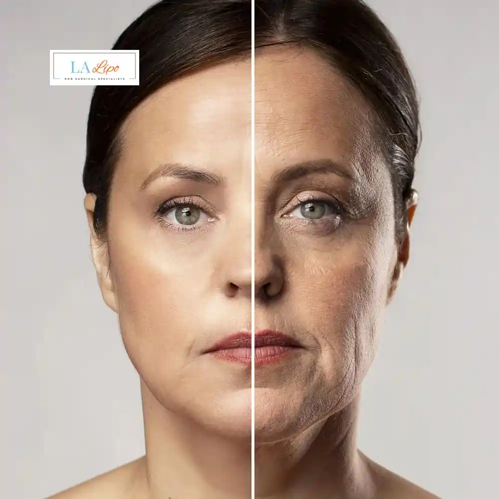 How Can You Tell If Non-Surgical Skin Tightening Is Right for You Northwood Hills?