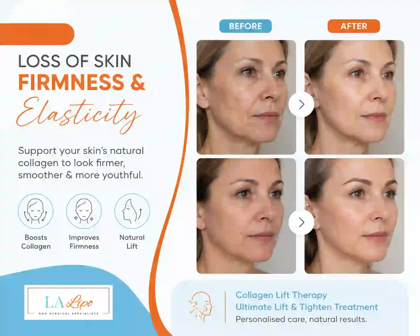 Sign #7: Loss of Skin Firmness and Elasticity Northwood Hills