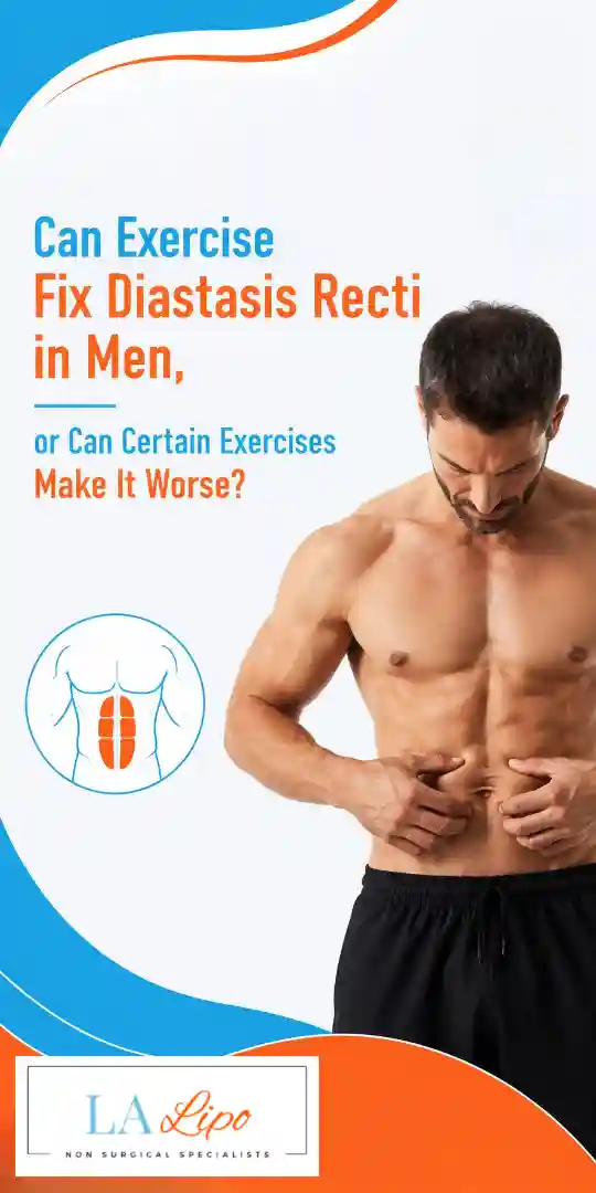 Can Exercise Fix Diastasis Recti in Men, or Can Certain Exercises Make It Worse Northwood Hills?