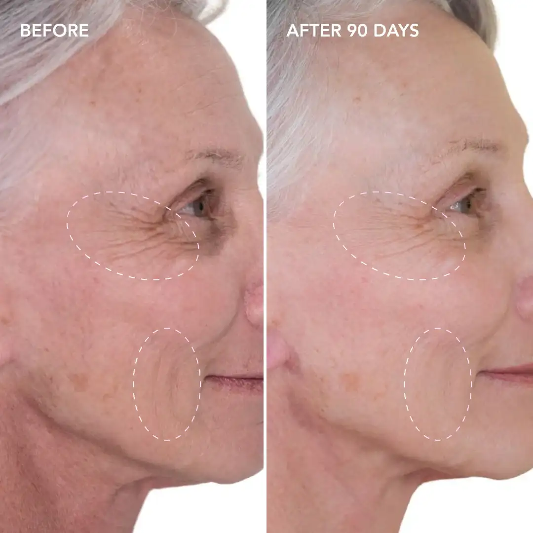 When will you see results Northwood Hills